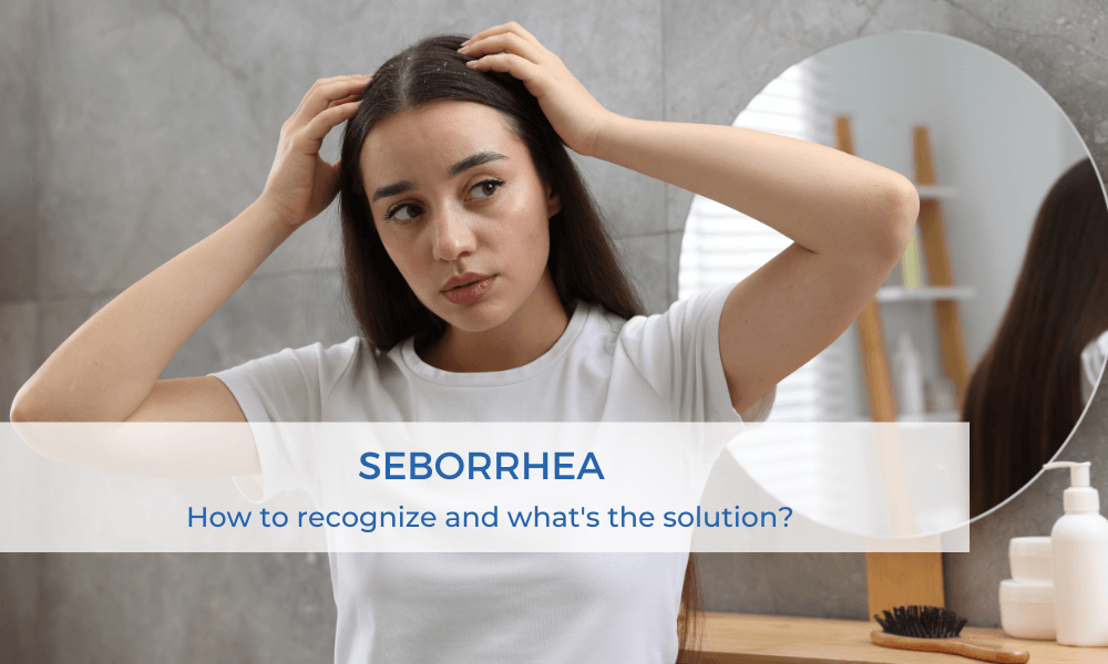 Seborrhea