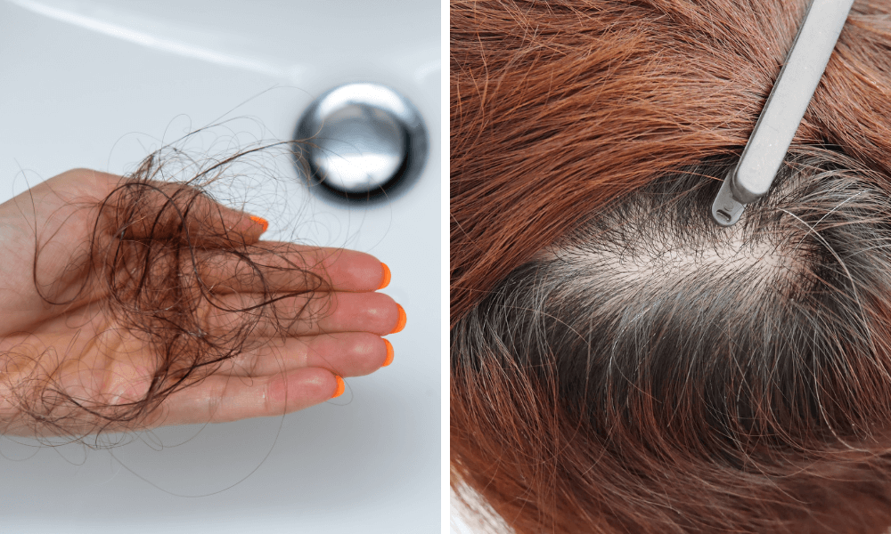 Against spring hair loss