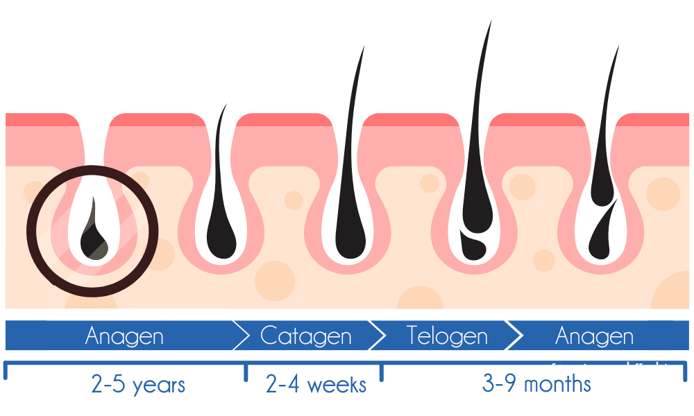 Chronic hair loss