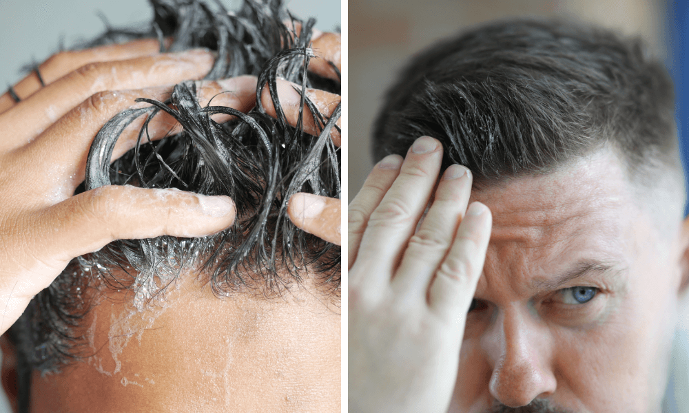 Men's hair care - Against men hair loss baldness