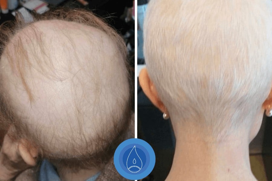 eredmenyek-oxigenterapia-25-03.jpg