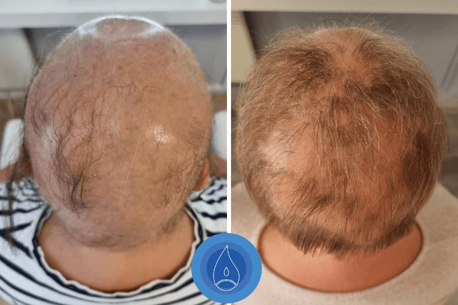 eredmenyek-oxigenterapia-25-05.jpg