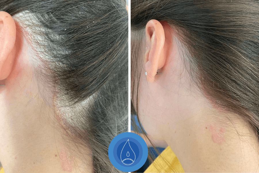 eredmenyek-oxigenterapia-25-06.jpg