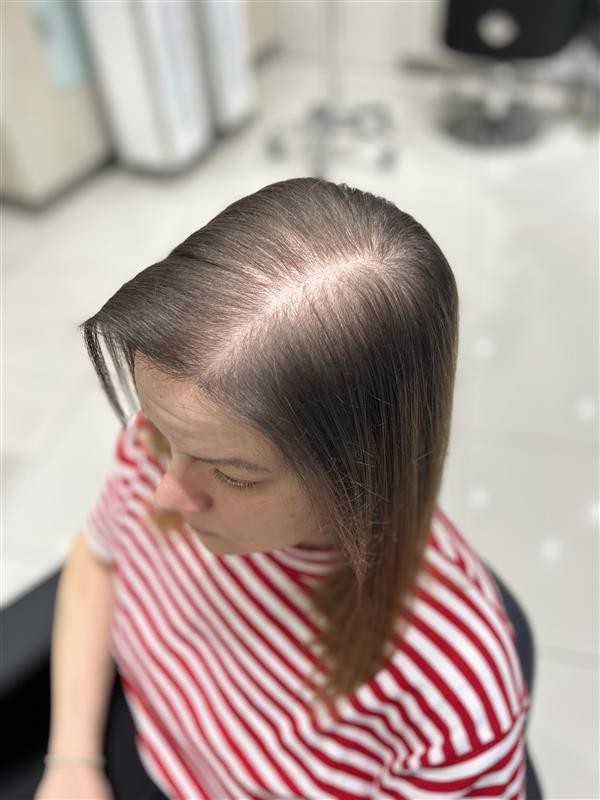 After