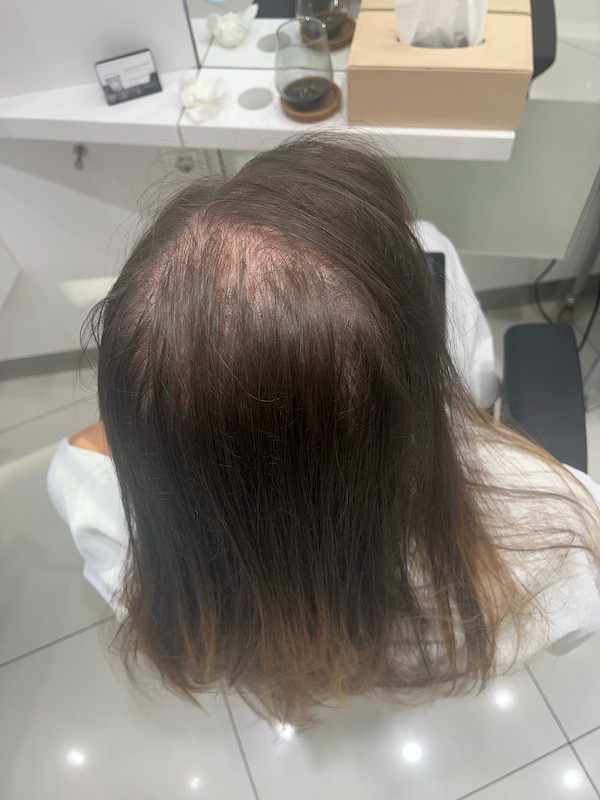 Before