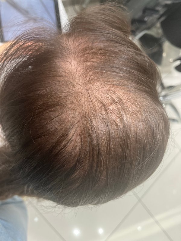 Before